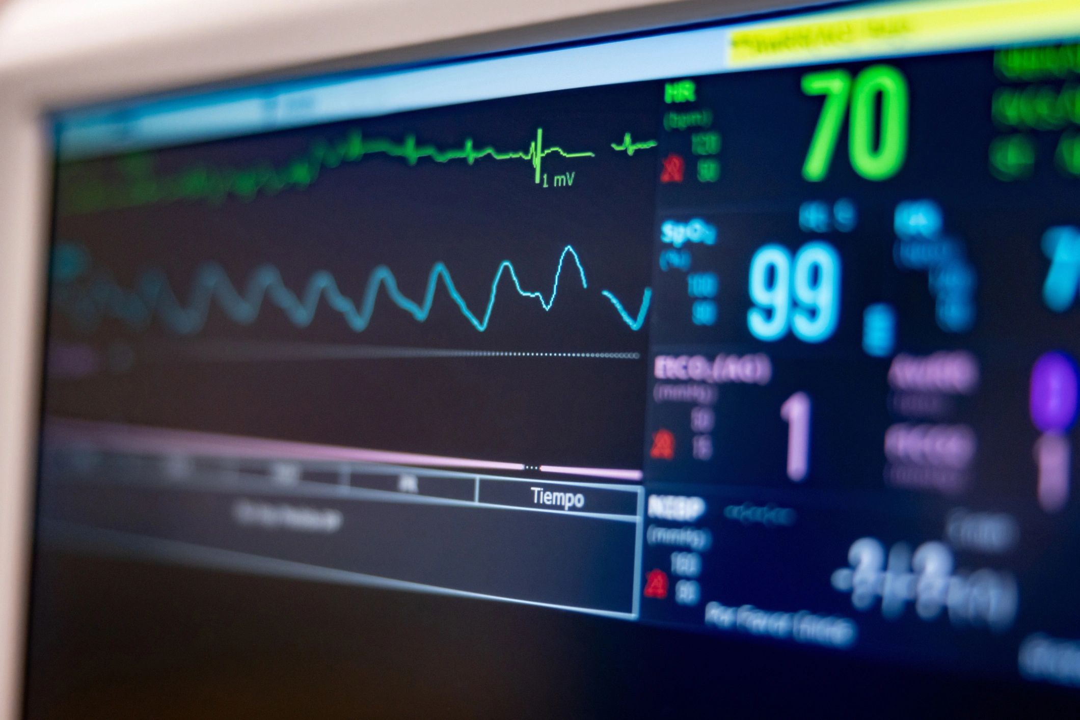 Hospital monitor displaying patient vital signs