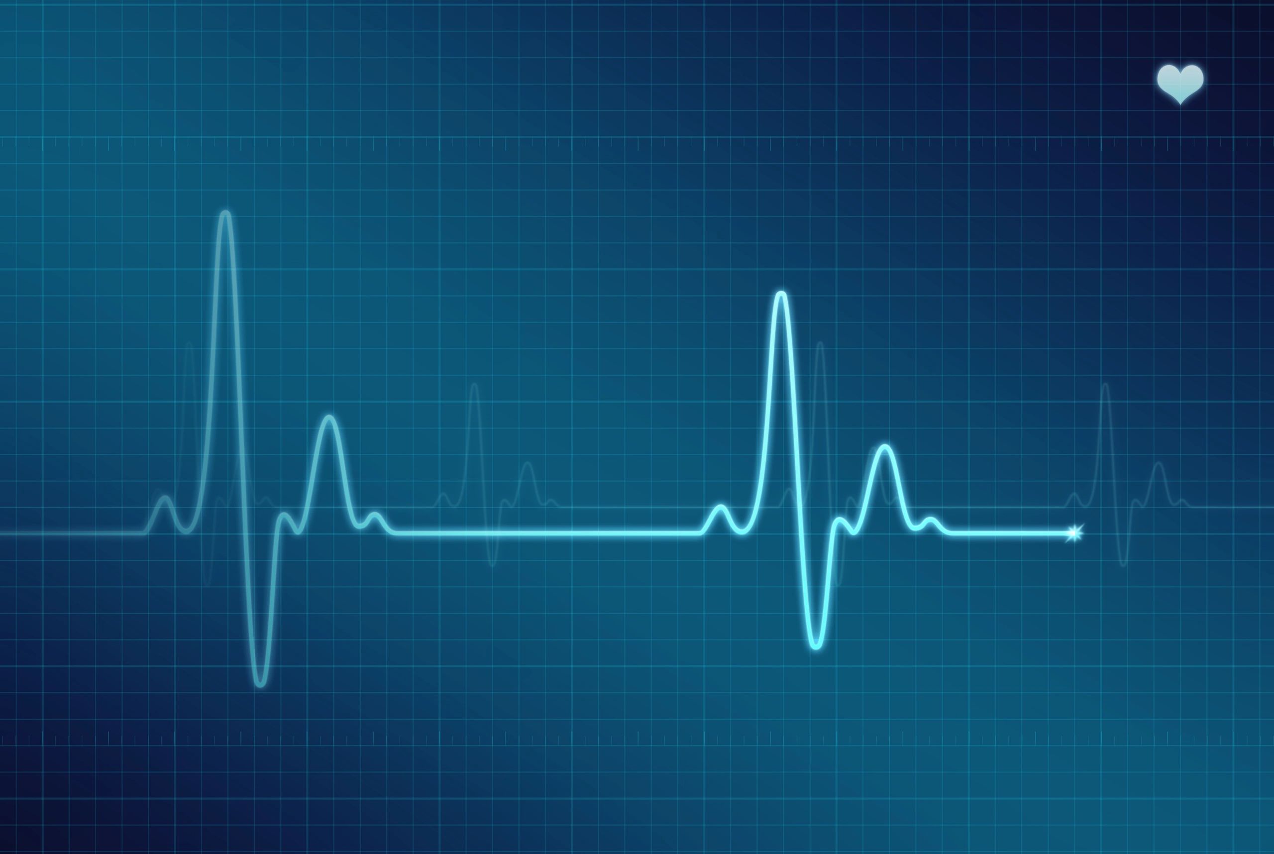 ECG line waveform on a dark background