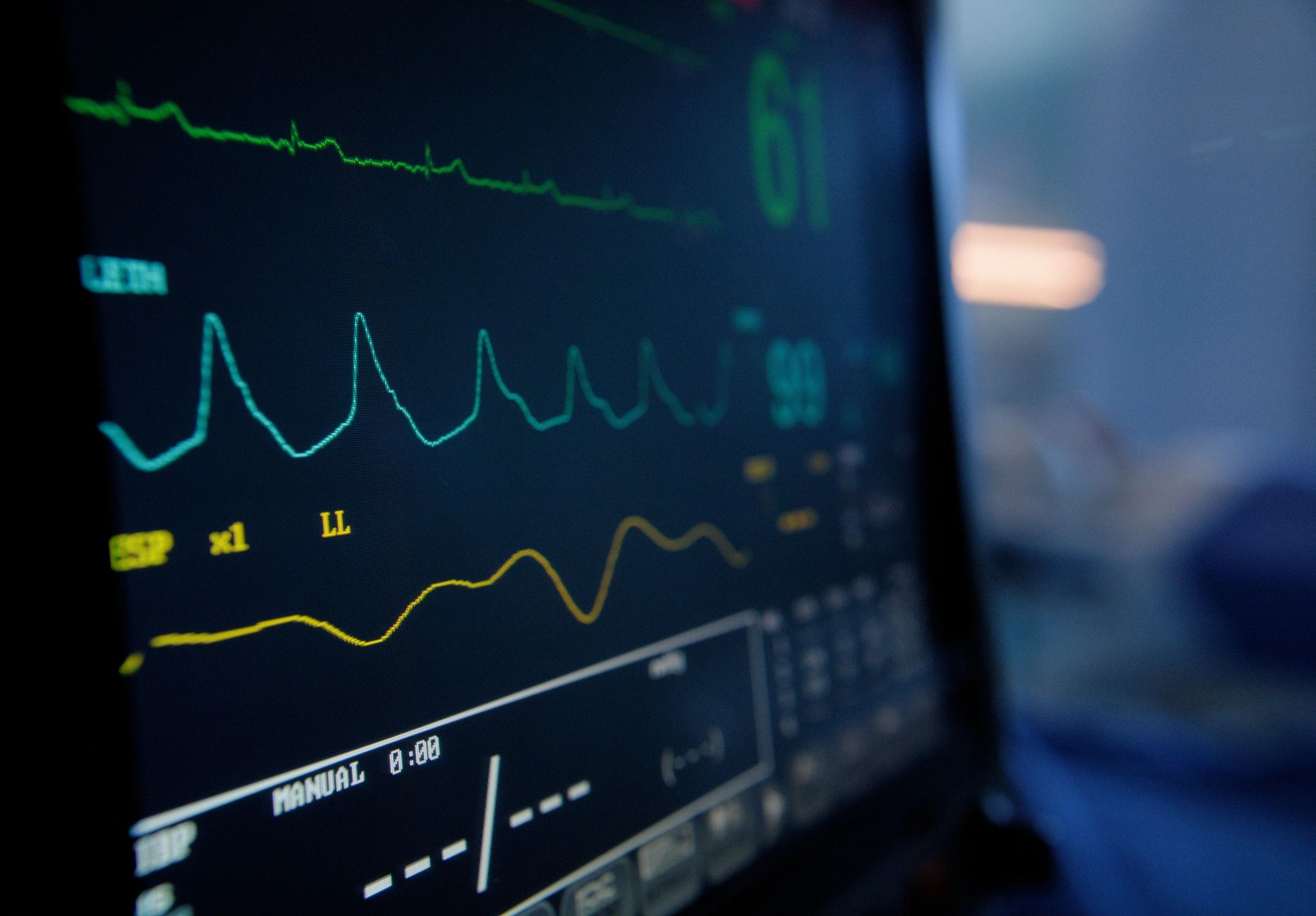 Vital signs monitor with ECG waveform on a dark screen